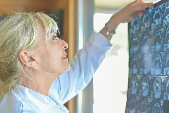 Portrait of a female doctor analyzing radiology images to define a medical diagnosis to treat cancer