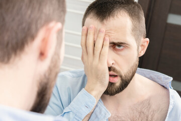 Fototapeta premium Man with a hangover and a headache looks in the mirror in the morning, portrait, close-up