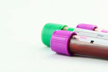 Vacuum tubes for collection and blood samples on white background..Transparent with purple and green lid. Label to identify the data. Selective focus. Macro.