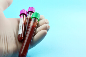 Hand with surgical glove holding vacuum tubes for collection and blood samples on blue...