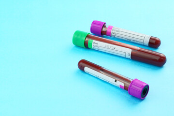 Vacuum tubes for collection and blood samples on blue background..Transparent with purple and green lid. Label to identify the data. Selective focus.