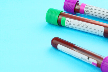 Vacuum tubes for collection and blood samples on blue background..Transparent with purple and green...