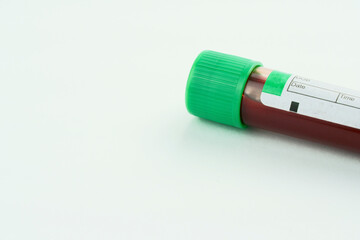 Vacuum tube for collection and blood samples on white background..Transparent with green cap. Label to identify the data. Selective focus.
