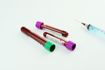 Vacuum tubes for collection and blood samples on white background..Transparent with purple and...