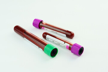 Vacuum tubes for collection and blood samples on white background..Transparent with purple and...