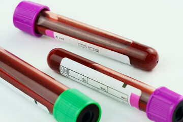 Vacuum tubes for collection and blood samples on white background..Transparent with purple and...