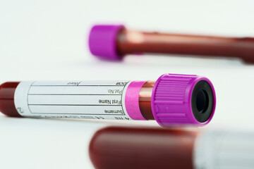 Vacuum tubes for collection and blood samples on white background..Transparent with purple and...