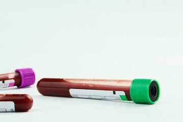 Vacuum tubes for collection and blood samples on white background..Transparent with purple and green lid. Label to identify the data. Selective focus.