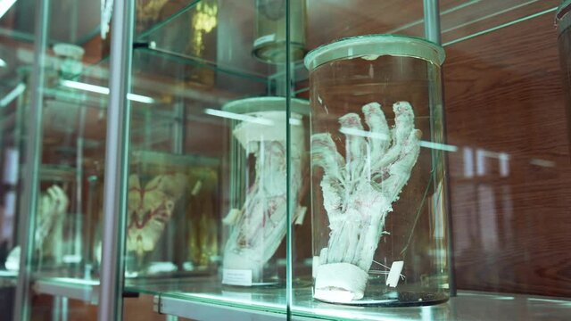 Human organs in museum. Human organs in formalin in anatomical museum