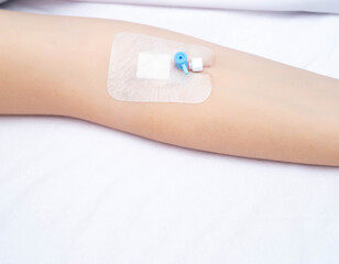 Venous catheter in the hand of a female patient on a white background, copy space for text, medical device,