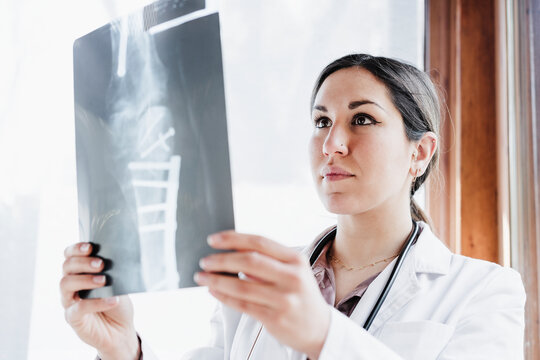 Female doctor looking at bone scan in hospital