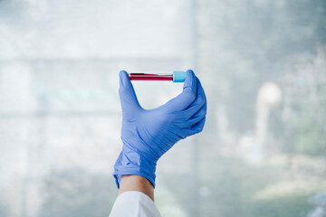 Female doctor holding blood sample in front of glass