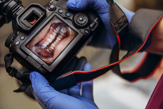 Doctor showsa picture of her teeth on camera