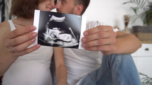 Slow Motion A pregnant young couple holds an ultrasound photograph of a child in