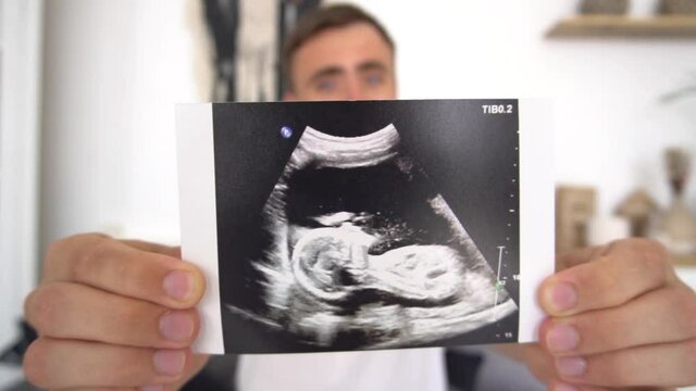 Cropped view of Father holding ultrasound scan of baby on bed, panoramic