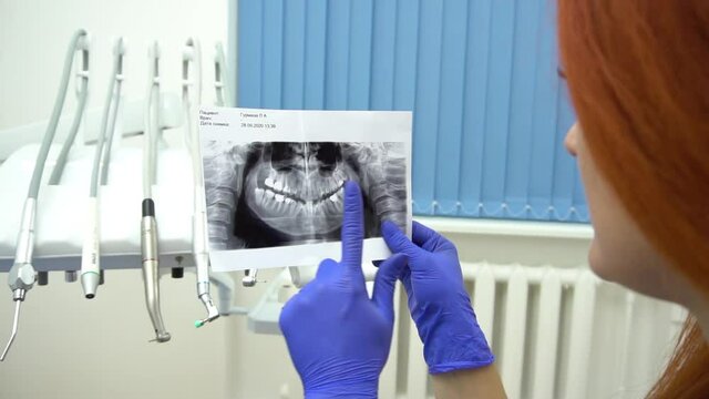 Slow Motion Female dentist holding a dental X-Ray