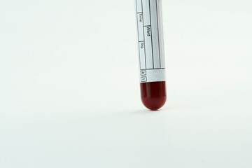 Vacuum tube for collection and blood samples on white background. Label to identify the data. Selective focus.