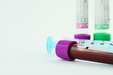 Vacuum tubes for collection and blood samples and a syringe on white background. Transparent tubes...