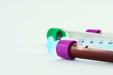 Vacuum tubes for collection and blood samples and a syringe on white background. Transparent tubes...