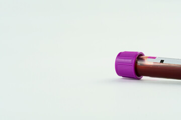 Vacuum tube for collection and blood samples on white background. Transparent tube with purple lid. Label to identify the data. Selective focus.