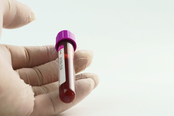 Hand with surgical glove holding vacuum tube for collection and blood samples on white background....