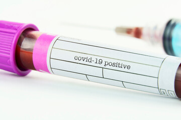 Vacuum tube for collection and blood samples and a syringe on white background.Transparent with...