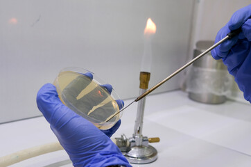 photo of culture bacteria by usin steel loop