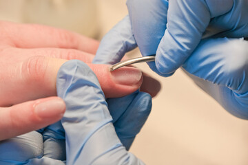 Fototapeta na wymiar Cuticle treatment with a manicure pusher. A manicurist wearing disposable protective gloves uses a manicure pusher, which makes it easier to gently push the cuticles back.