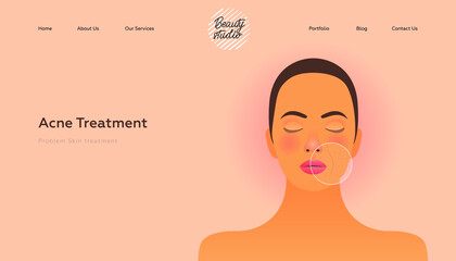 Acne Treatment. Problem Skin Treatment. Beauty Studio Landing Page Design Template. Website Banner. Magnifying Circle Demonstrate Problem Skin on Young Female Face.