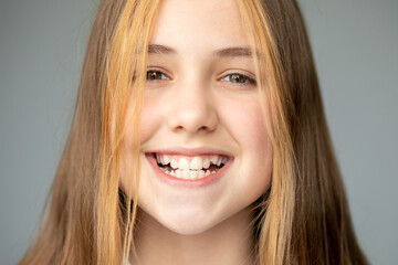 Naklejka premium Teenage girl smiling and showing jagged teeth, dental medicine and healthcare