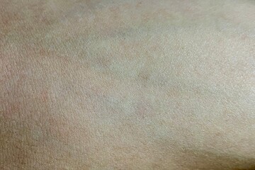 Tender young body skin background