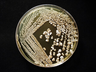 Top down view of a Petri plate containing colonies of Streptomyces bacterium, on black background. 