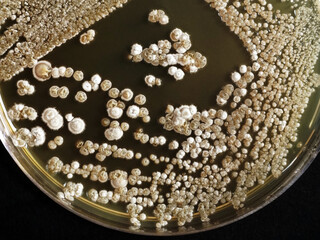 Top down view of a Petri plate containing colonies of Streptomyces bacterium, on black background. 