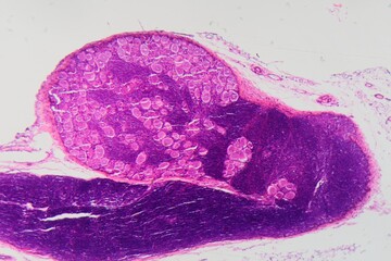 Longitudinal section of human spinal ganglion cells under the microscope.