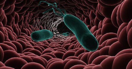 Helicobacter pylori infection, the agent of gastric ulcer, in 3d illustration