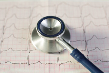 Medical stethoscope and cardiogram. Close-up. Diagnosis and examination concept