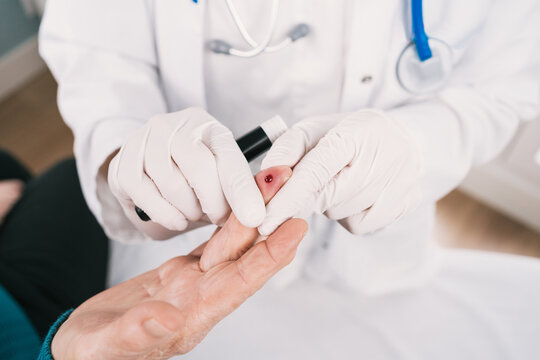 From above of crop unrecognizable doctor in sterile gloves taking blood test of patient with lancet in hospital