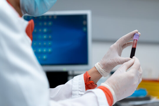 Unrecognizable female medic in mask and gloves holding tube with blood sample in modern lab in clinic