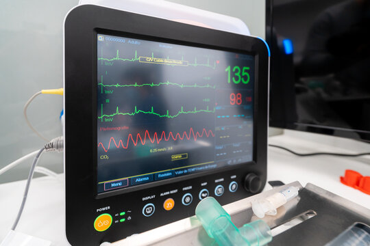 Professional medical device showing heart rate graphs and numbers on display on table in clinic