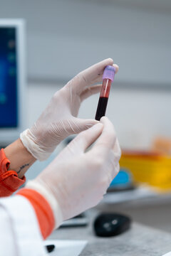 Unrecognizable female medic in mask and gloves holding tube with blood sample in modern lab in clinic