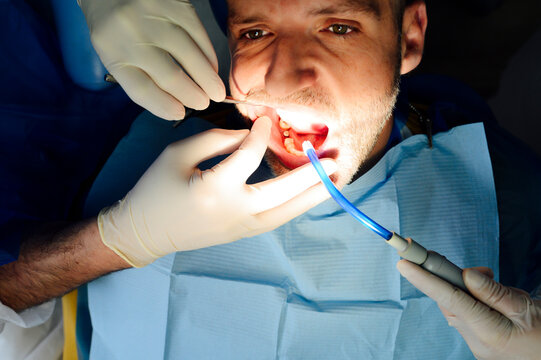 Crop anonymous orthodontist in latex gloves with coworker checking up teeth of mature man looking forward in hospital