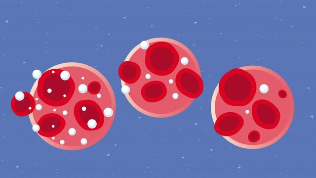 blood with diabetes microscopic view set