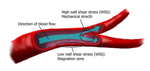 The physiology of blood flow in cerebral artery and wall shear stress.
