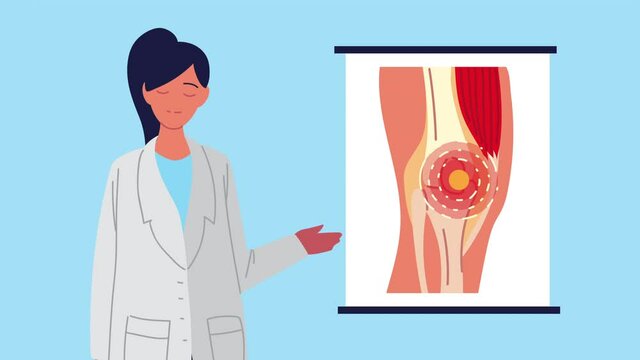 doctor with knee pain rheumatology disease animation