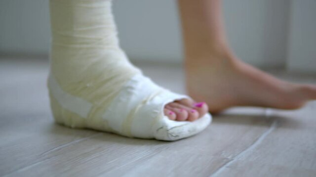 Close-up of woman's broken foot in plaster cast trying to walk, rehabilitation at home after leg injury concept