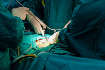 Medical team of surgeons in hospital doing minimal invasive surgical interventions. Surgery operating room with electrocautery equipment for cardiovascular emergency surgery center.