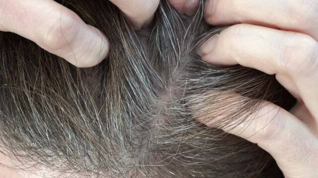 Closeup Shot Of A Middle Aged Woman Itching Her Scalp In The Part Of Her Dyed Hair With Gray Roots.