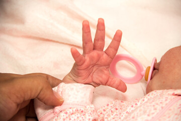 Newborn Baby Girl with pacifier with  an unhealthy rash in her open palm hand and mother holding her
