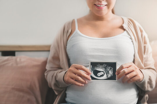 Asian pregnant woman holding ultrasound scan image, Expectation of a child and Maternity prenatal care and woman pregnancy concept.