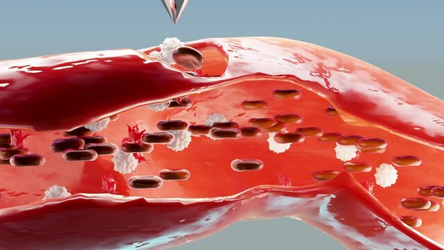 Hemostasis. Red blood cells and platelets in the blood vessel. Basic steps of wound healing process. animation. 3d render. cross section